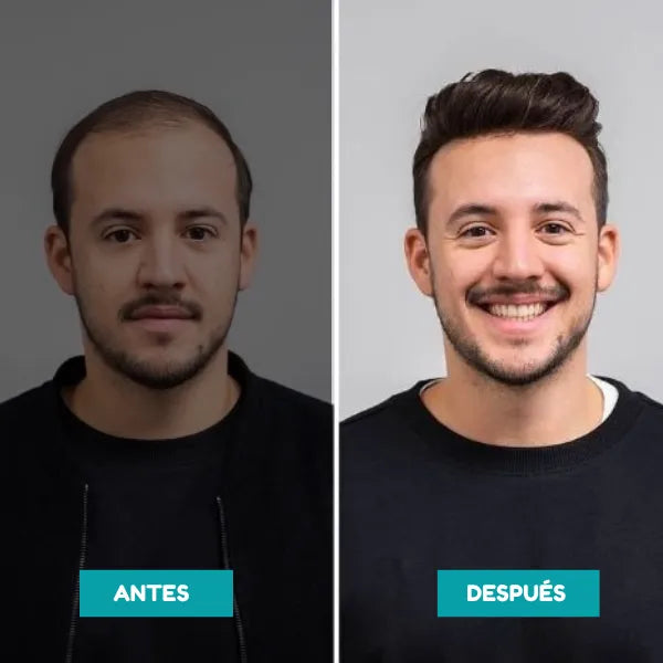 Gomitas Black Sea Para Crecimiento Capilar Y Barba Natural Sin Complicaciones