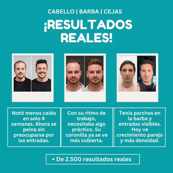 Gomitas Black Sea Para Crecimiento Capilar Y Barba Natural Sin Complicaciones